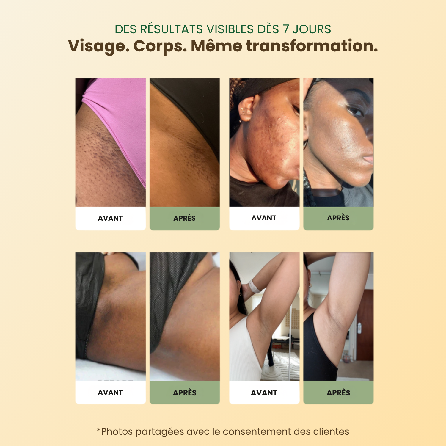 Savon Anti-Taches & Hyperpigmentation  (+200g OFFERTS)